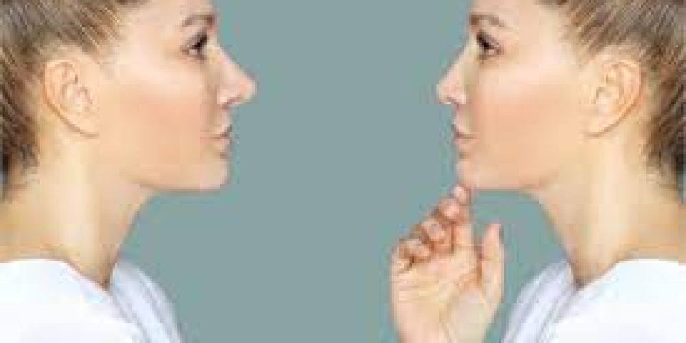 To feel good about their appearance, many people turn to the nose job Beverly Hills
